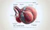 Self-Exams for Testicular Cancer: Essential Detection Tips