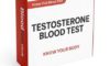 TRT Monitoring: Essential Blood Tests in the UK Explained