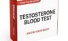 Testosterone Blood Test Overview for Residents of Derby