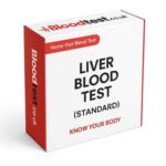 Liver Blood Test Options and Essential Information in Darlington